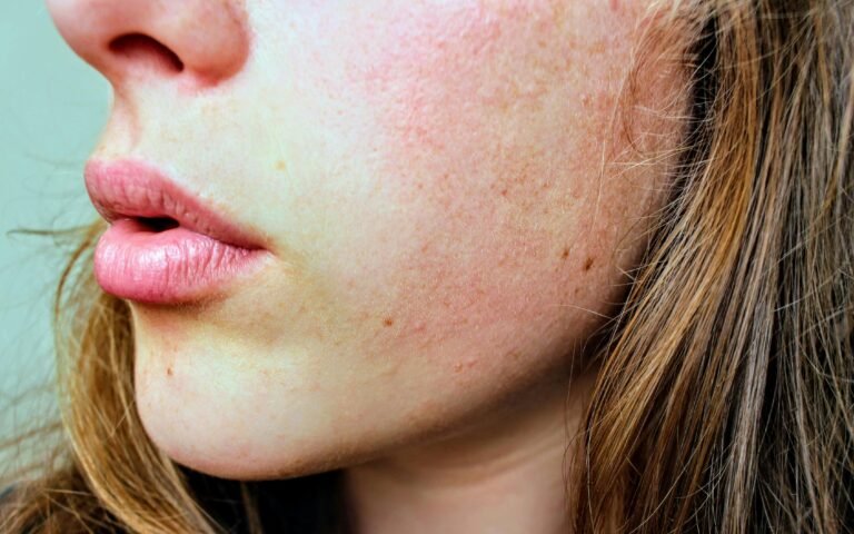 How To Do Local Seo For Dermatologists: A Practical Guide